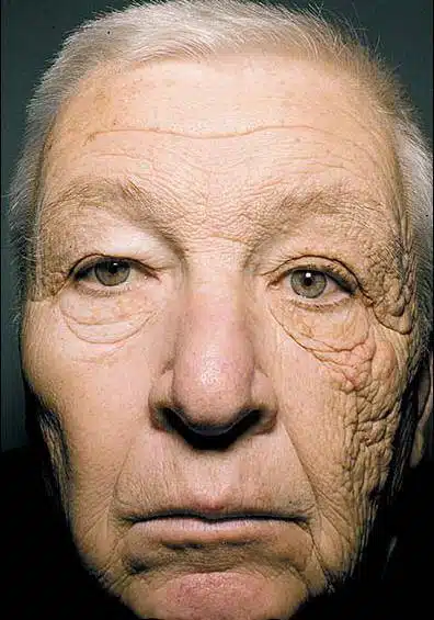 SPF در ضد آفتاب