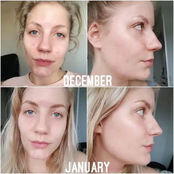 سرم رتینول اوردینری ordinary retinol serum