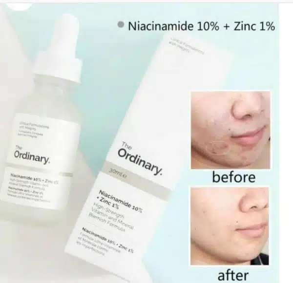 سرم ضد جوش نیاسینامید 10% + زینک 1% اوردینری(اصل) - تصویر 4