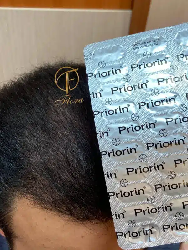 مکمل پریورین اصل