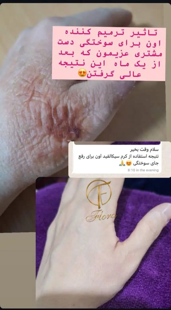 کرم ترمیم کننده سیکالفیت اون(اصل) - تصویر 9